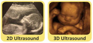 Our Services - Image of a Miracle 4D Ultrasound Center