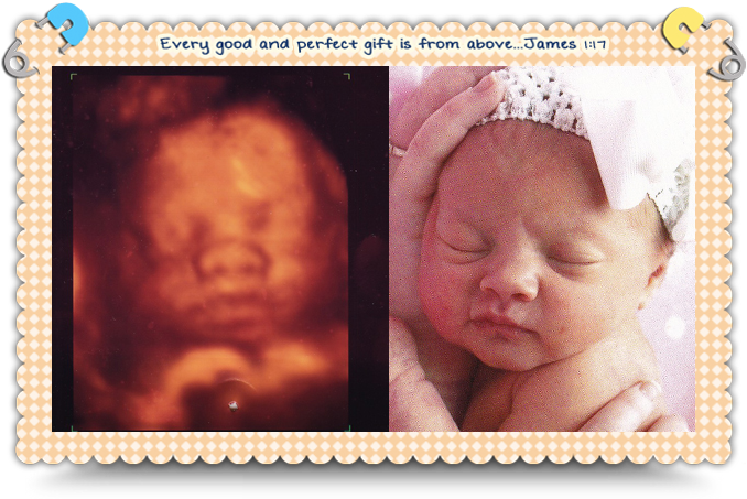 Image Of A Miracle 4d Ultrasound Center Hear The Heartbeat And See The Face Of Your Miracle