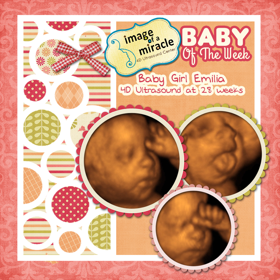 Baby of the Week Image of Miracle 4D Ultrasound