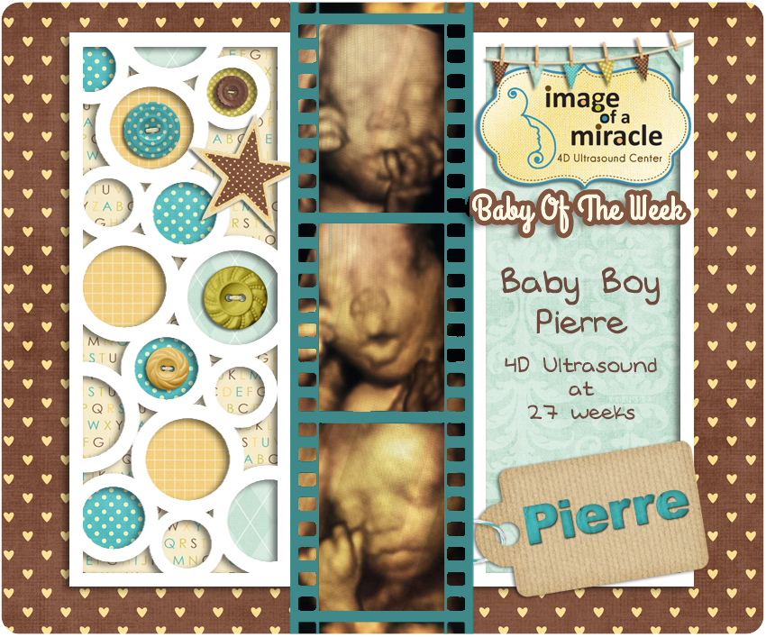 7/5/14 Baby of the Week - Baby Boy Pierre