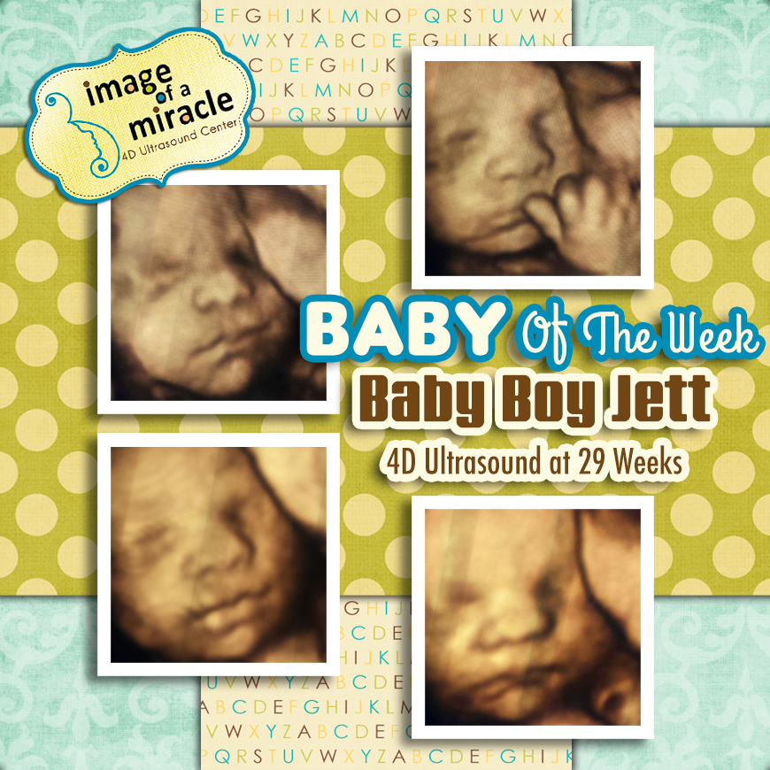 Baby Boy Jett - Image of a Miracle 4D Ultrasound Center Columbus GA