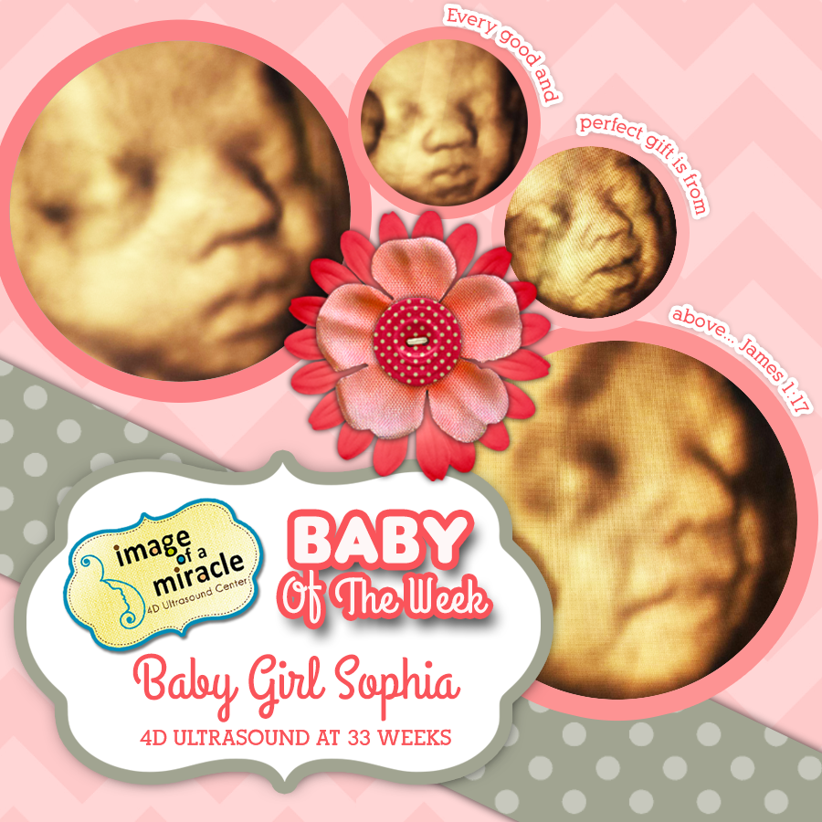 Baby Girl Sophia - Image of a Miracle 4D Ultrasound Center Columbus GA