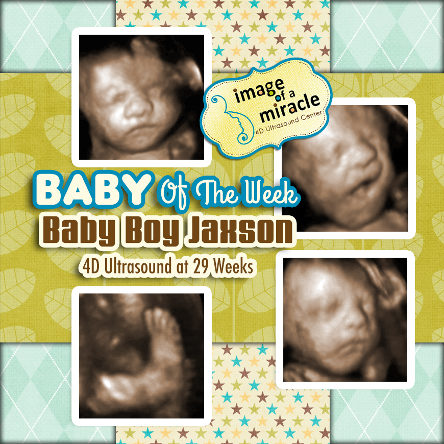 Baby Boy Jaxson 4D Ultrasound Columbus GA