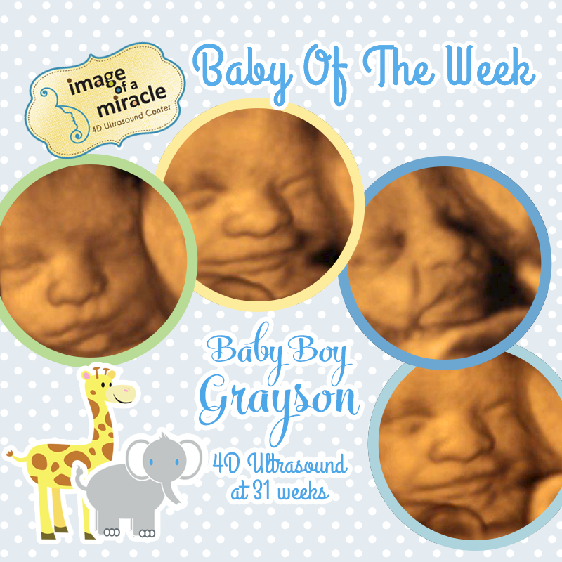 Baby Of The Week Archives Page 5 Of 6 Image Of A Miracle 4d Ultrasound Center