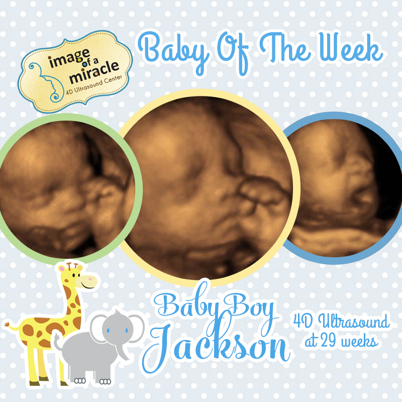 Image of a Miracle 4D Ultrasound Baby of the Week
