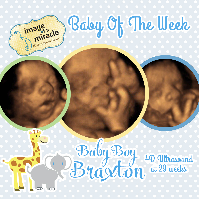 Our Baby of the Week is Baby Boy Braxton! His 4D Ultrasound was done at 29 weeks. We got several cute poses of his hands and face.