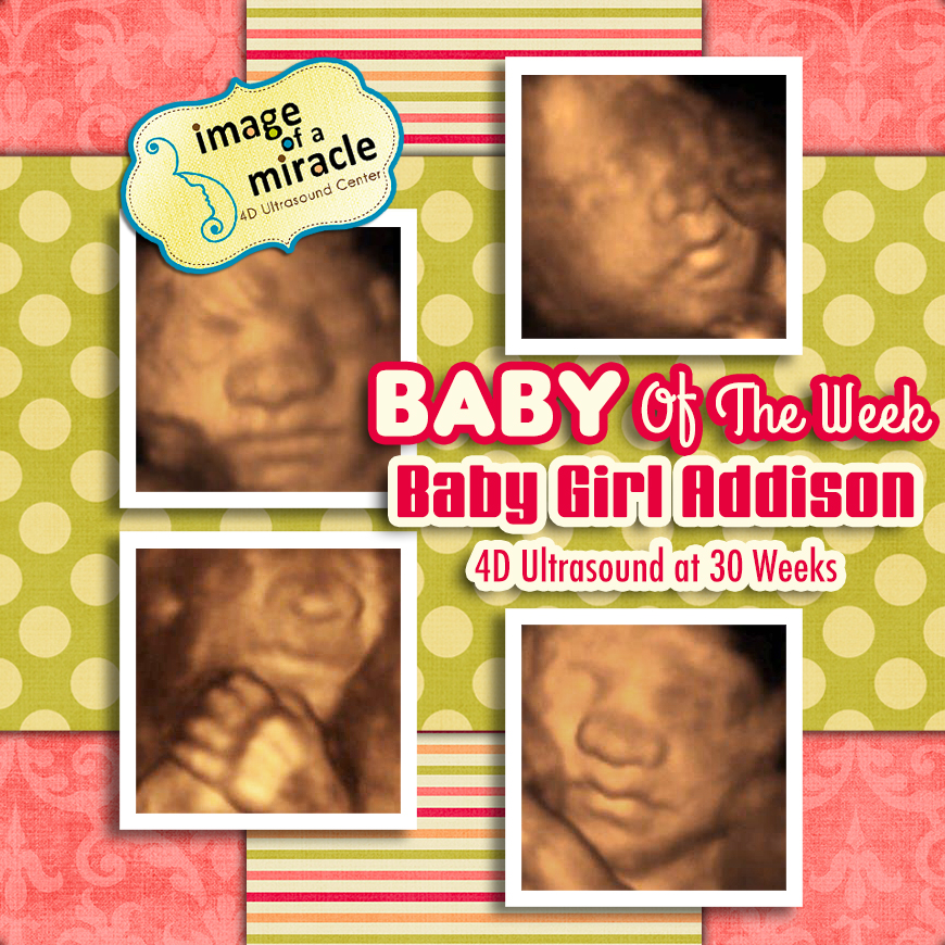 Our Baby of the Week is Baby Girl Addison! Her 4D Ultrasound was done at 30 weeks. We got several cute poses of her hand and face.