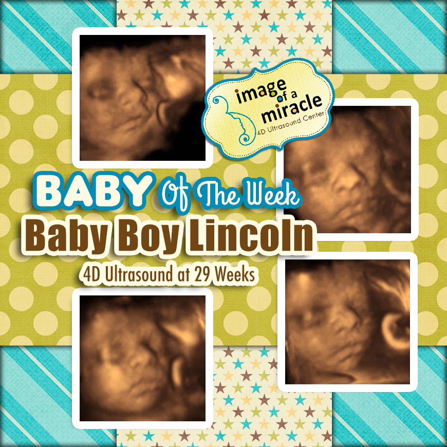 Our Baby of the Week is Baby Boy Lincoln! His 4D Ultrasound was done at 29 weeks. We got several cute images of his face and even a glimpse of a smile!