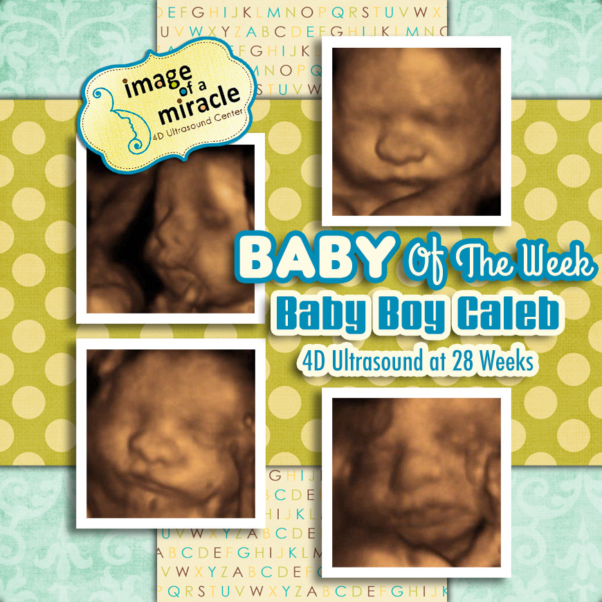 Our Baby of the Week is Baby Boy Caleb! Hi8 4D Ultrasound was done at 25 weeks. We got several cute poses of his hand and face.