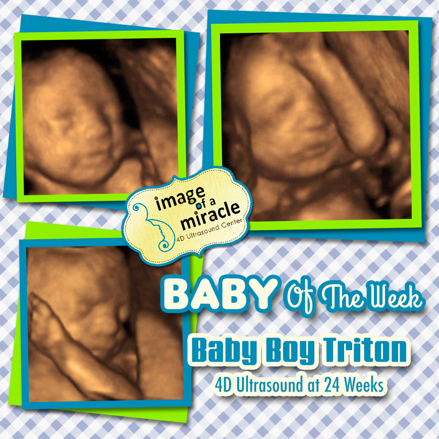 Our Baby of the Week is Baby Boy Triton! His 4D Ultrasound was done at 24 weeks. We got several cute poses of his hand and face.