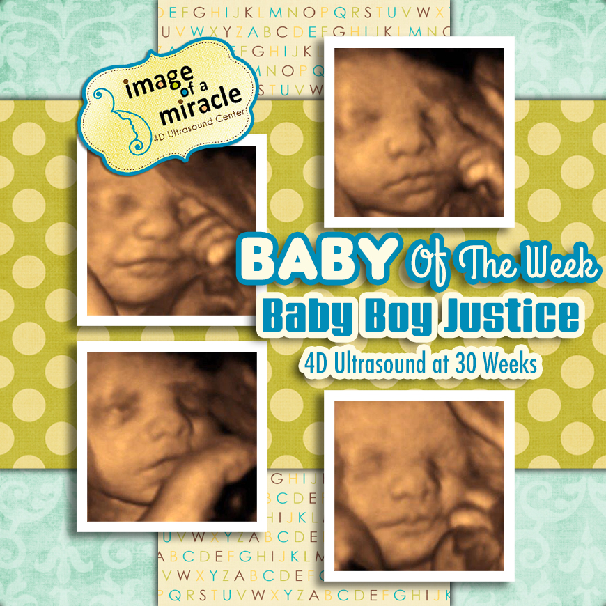 Our Baby of the Week is Baby Boy Justice! Hi8 4D Ultrasound was done at 30 weeks. We got several cute poses of his hand and face.