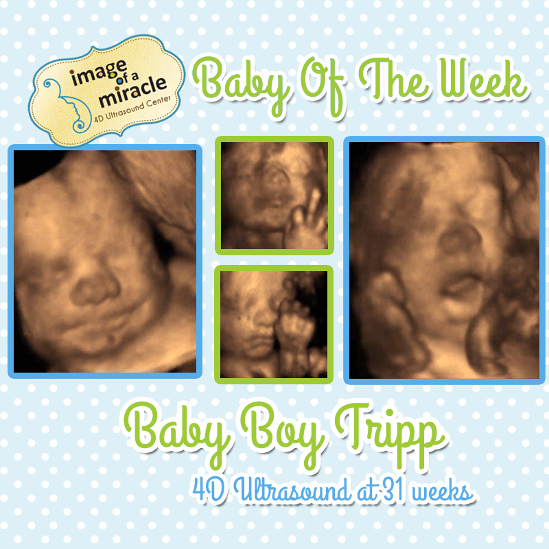 baby-boy-tripp