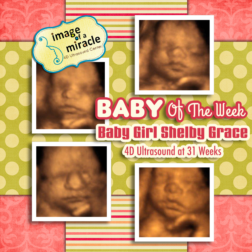 baby-GIRL-SHELBY