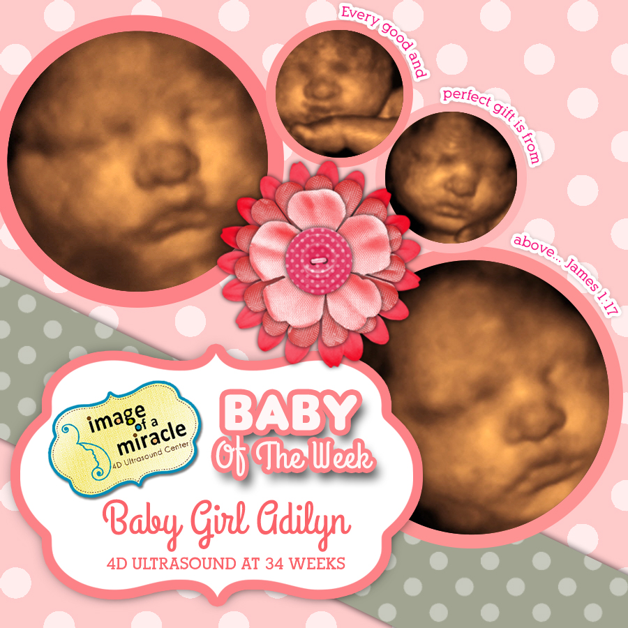 baby-girl-adilyn