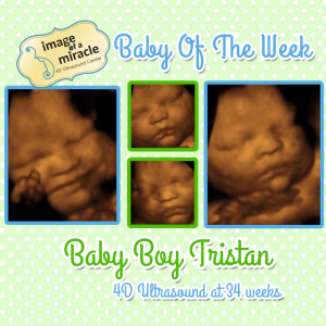 4D Ultrasound Columbus GA 34 weeks