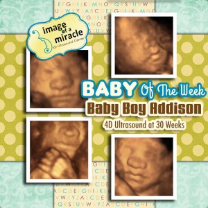 Our Baby of the Week is Baby Boy Addison! His 4D Ultrasound was done at 30 weeks. We got several cute poses of his hand and face.